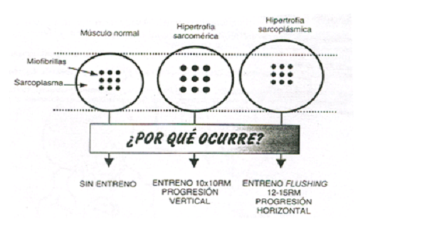 Diferencias entre hipertrofia sarcomérica y sarcoplásmica