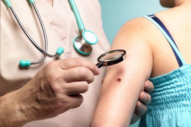 10 consejos de dermatólogos para prevenir el cáncer de piel