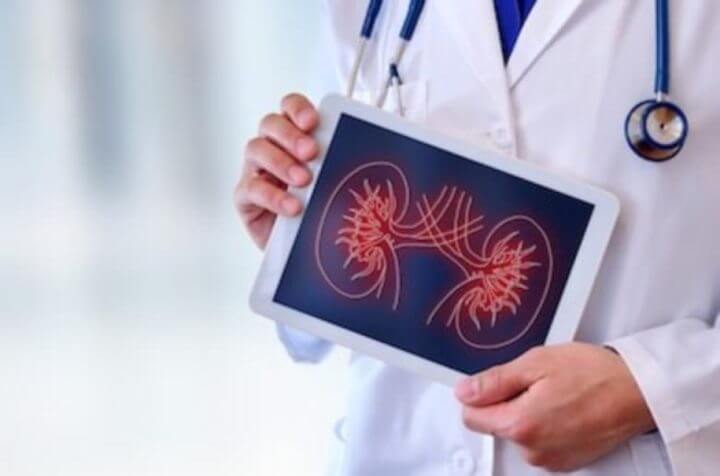 Terapia de Nutrición Médica para pacientes con problemas renales