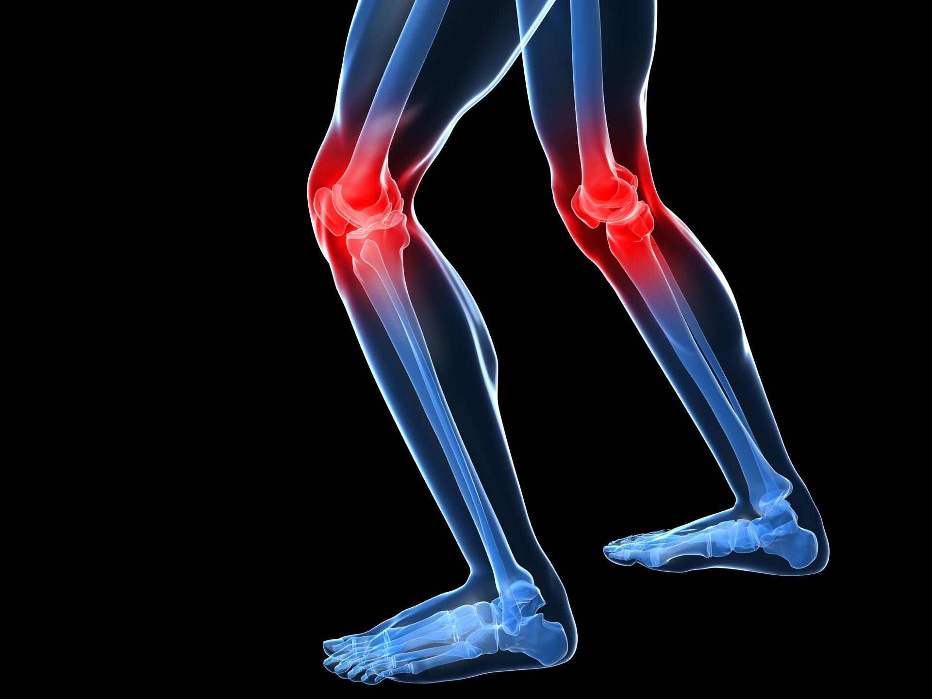 Cómo prevenir la peor lesión para un runner | Entrenamiento