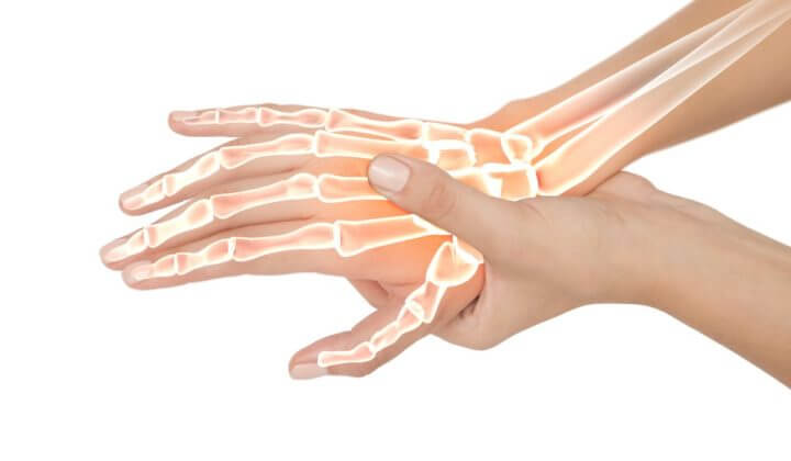 Alivia el dolor de articulaciones con suplementos de colágeno