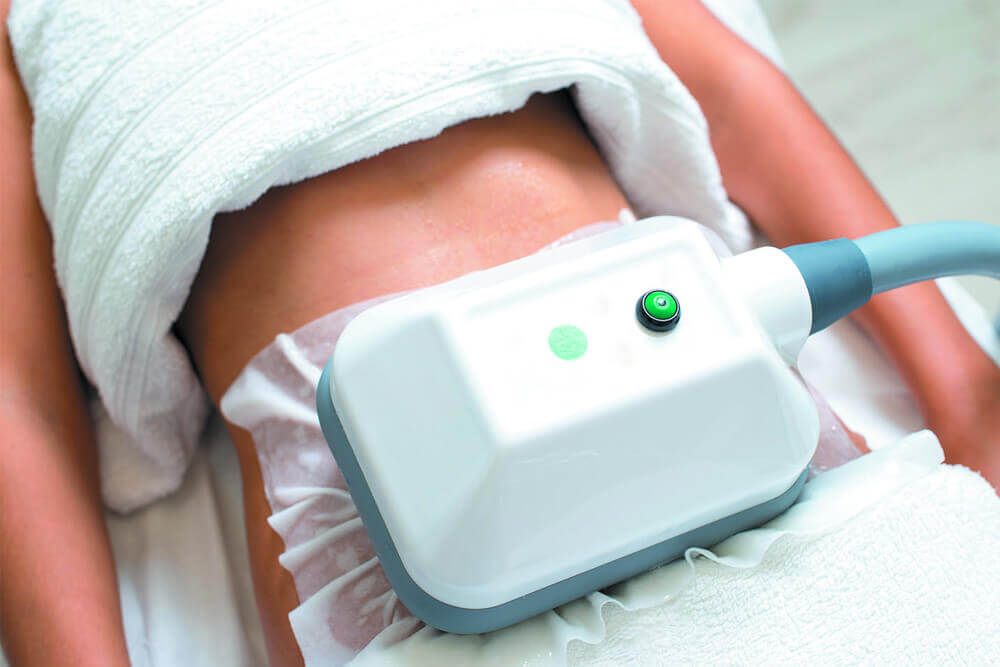 COOLSCULPTING PARA LA ELIMINACI N DE GRASA LOCALIZADA visual data 6