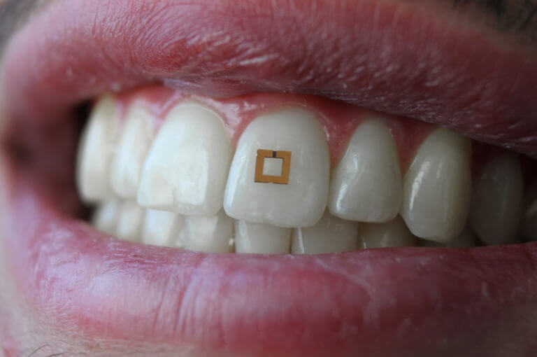 ¿pueden los sensores dentales ser la solución para adelgazar?