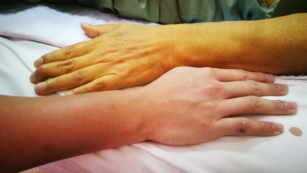 Los efectos que puede tener la quimioterapia en el hígado