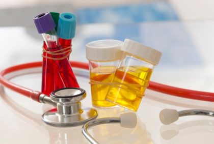 La guía definitiva para descifrar tus analíticas de sangre