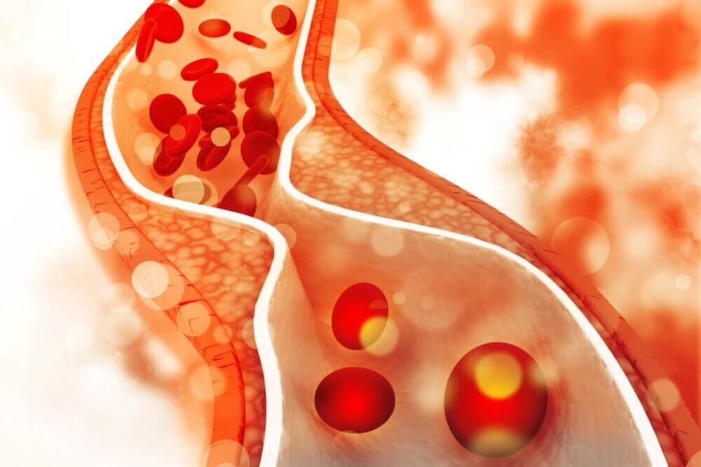 Debate entre el colesterol HDL vs LDL