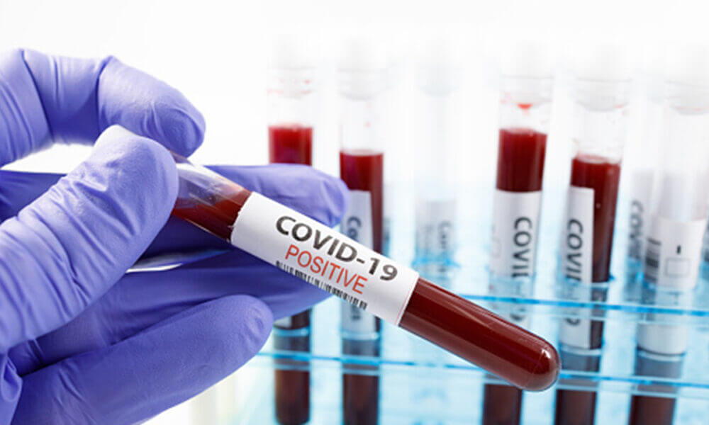 Estudios de las causas de empeoramiento en casos de coronavirus