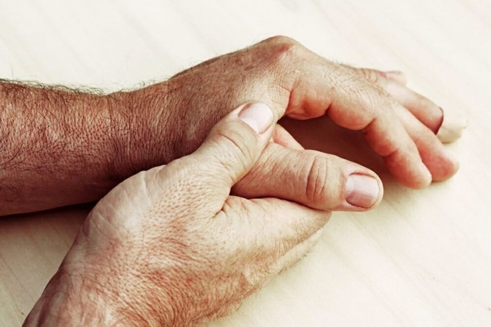 tratamiento de la esclerodermia
